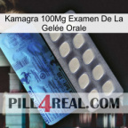 Kamagra 100Mg Examen De La Gelée Orale 34